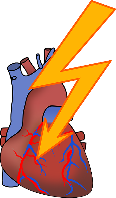 心律失常 心脏病发作 心脏 - 免费矢量图形