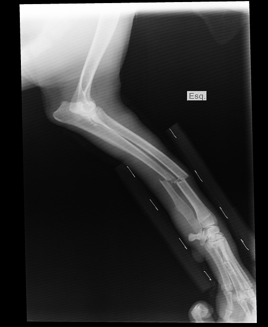 断臂 X射线 肉桂的 - 上的免费照片