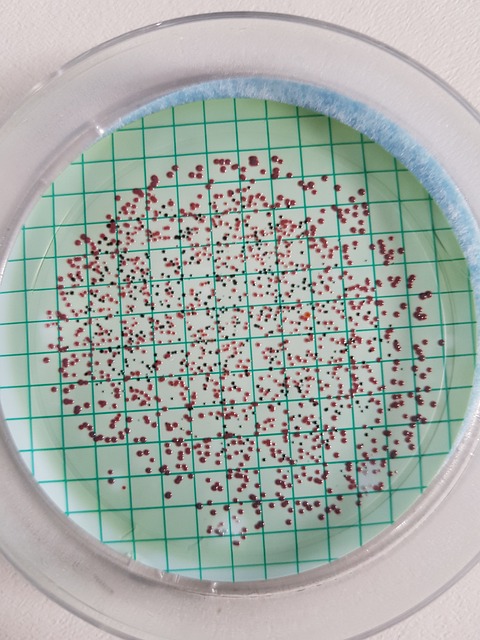 微生物学 细菌学 水微生物学 - 上的免费照片