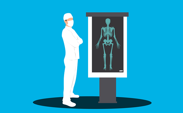 医生 X射线 骨骼 - 免费矢量图形