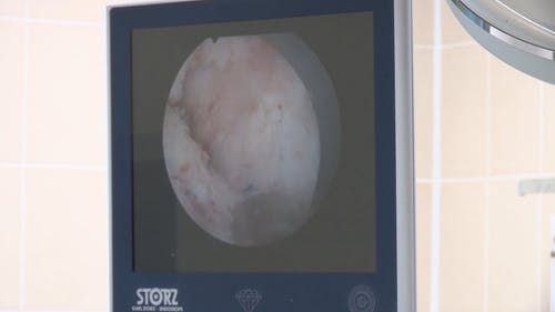 医院设备监视器上使用的高精度相机成像 · 免费素材视频